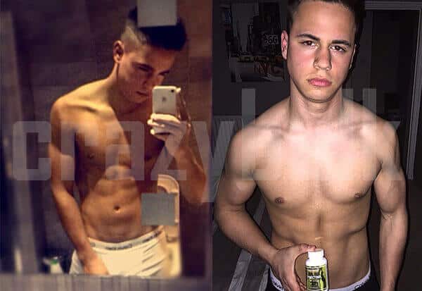 Man Boobs Before and After Gynectrol Moobs Store Online